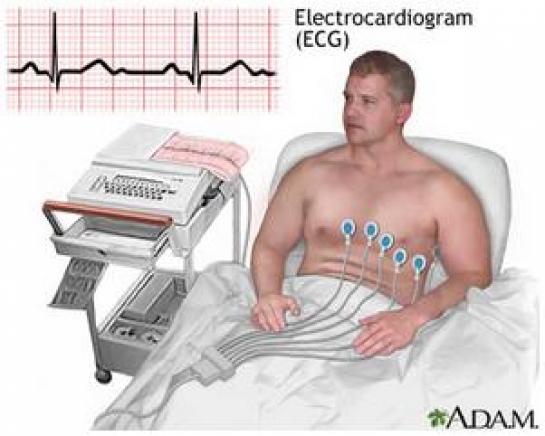 Prosedur Pemeriksaan Elektrokardiografi